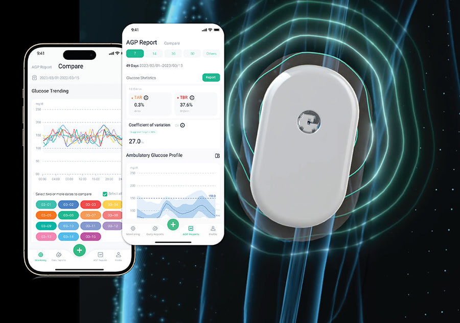 Application SIBIONICS sur smartphone connectée au capteur GS1 : courbe de glycémie et rapport AGP